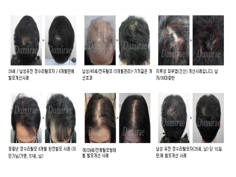 두미래 임상 사례 모음 3